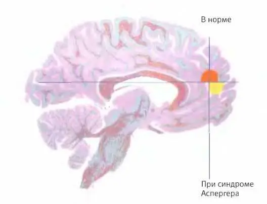 Когда здоровый человек знакомится с текстом в котором рассказывается о чьемто - фото 119