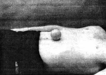 Рис 61 Большой резиновый шарик для катания в области желудка по таким - фото 12