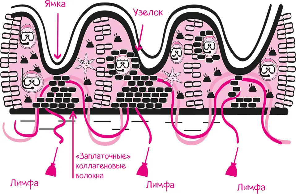 Последнюю стадию целлюлита чрезвычайно редко диагностируют у молодых девушек - фото 84