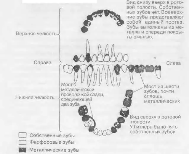 Схема зубов Гитлера выполнена профессором Согнесом по материалам допроса - фото 28