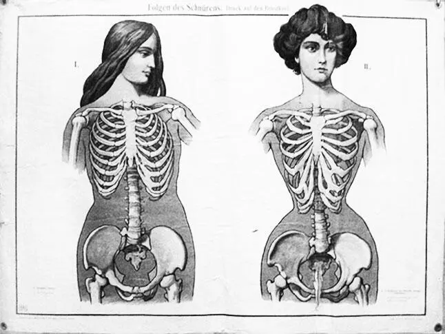 Плакат 1884 г демонстрирующий деформацию скелета женщины в результате ношения - фото 490