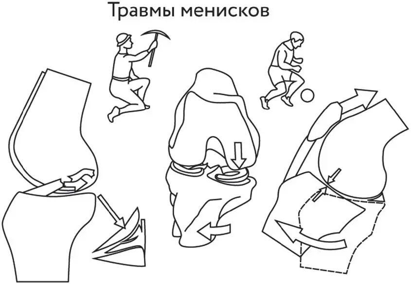 Рис 7 Часто в основе повреждения лежит травма связок Что это значит Дело в - фото 171