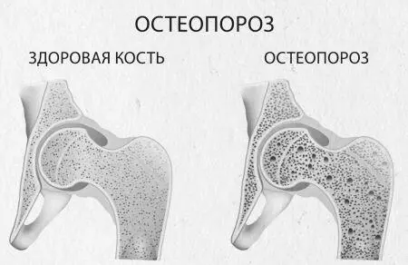 Симптомы которые могут возникать в первую очередь подразделяются на две - фото 504
