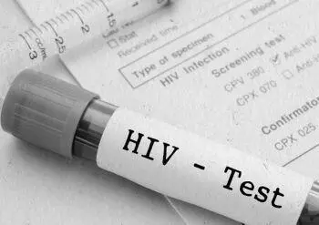 Только в некоторых случаях после инфицирования присутствуют симптомы ВИЧ в - фото 576