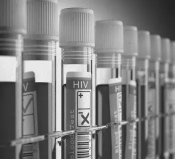 Заболевания обусловленные нарушениями в функционировании эндокринной системы - фото 579