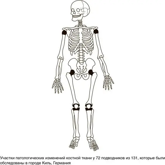 В 1997 г в British Medical Journal появилась тревожная статья С помощью - фото 35