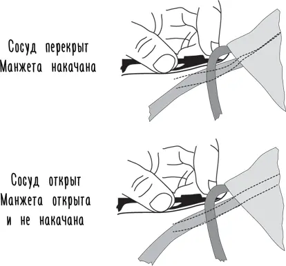 Измерение давления линии обозначают артерии проходящие в руке Во врачебной - фото 26