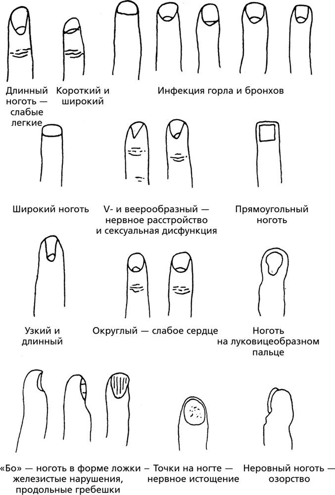 Форма и вид ногтей Ногти состоят из вещества называемого кератином Это - фото 43