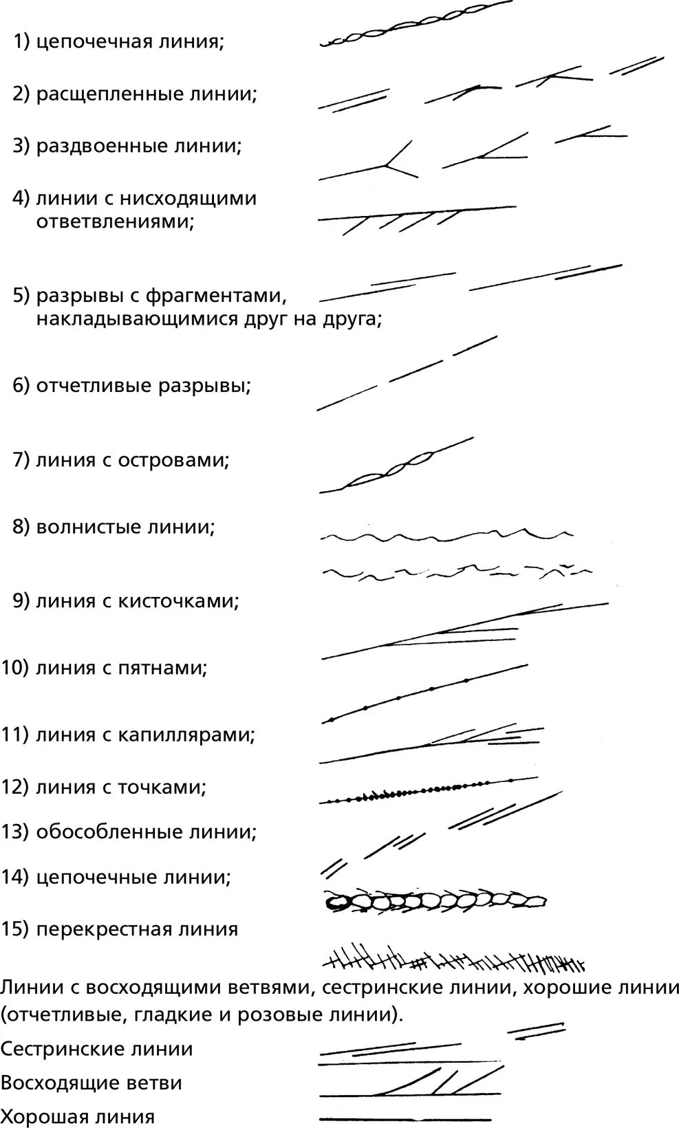 Дефекты линий Линия Жизни Линия Жизни обходит полукругом холм Венеры - фото 46