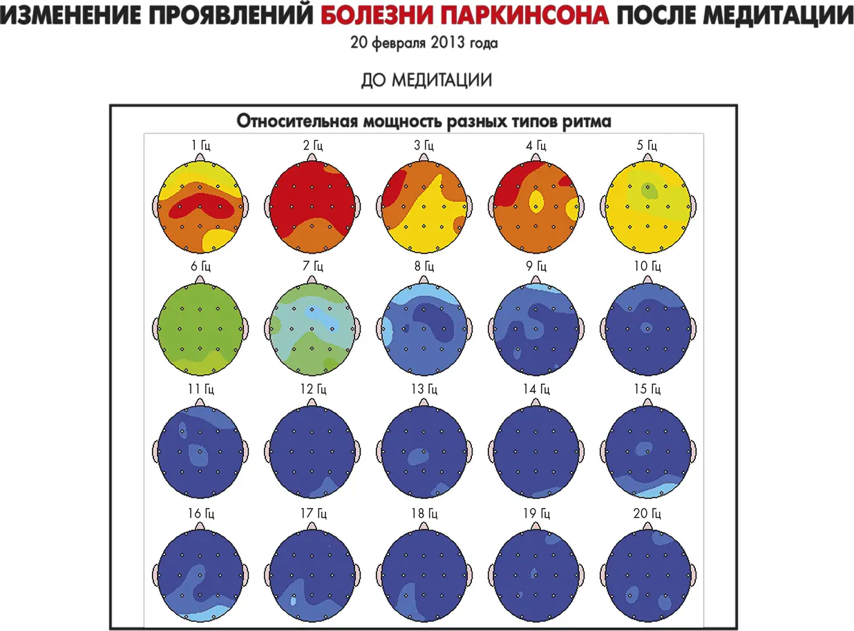 Рисунок 106А Теперь взглянем на данные QEEG до медитации рисунок 106A - фото 40