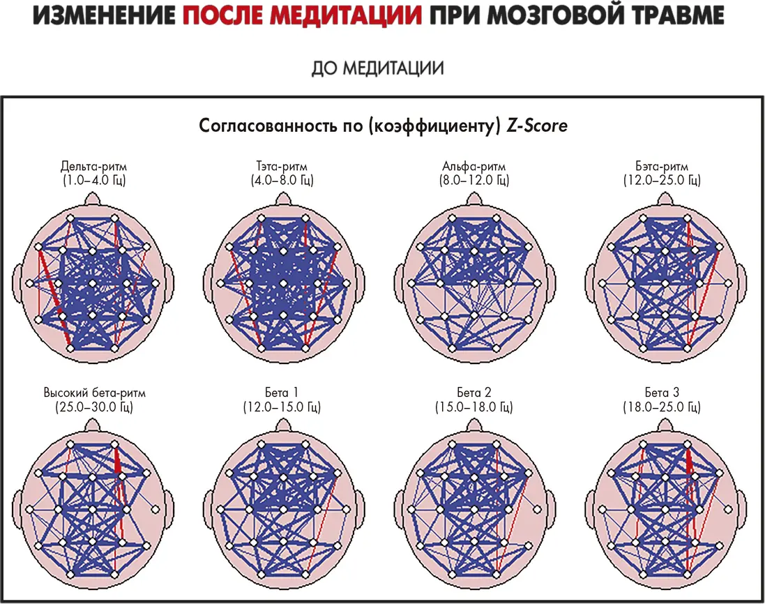 Рисунок 107 Сканы ДжонаВзглянем на скан мозга Джона до медитации на - фото 46