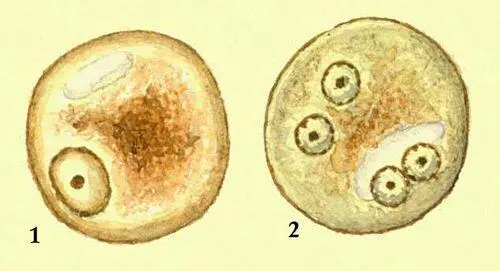 Дизентирийная амеба Entamoeba histolycia 1 вегетативная одноядерная форма - фото 450