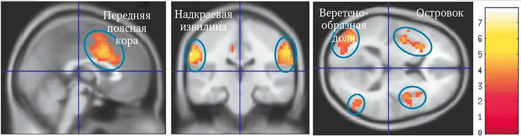 Матрицей боли называют несколько участков мозга которые активируются когда вы - фото 74
