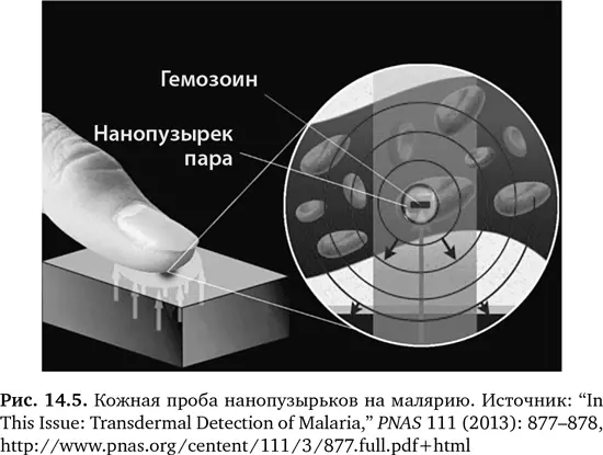 Новые способы быстрого диагностирования малярии которая убивает примерно 600 - фото 52