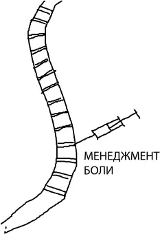 Рис 13А При такой блокаде препарат точно попадает к нужному нервному корешку - фото 15