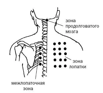 Рис 10 а 2Затем тем же приемом по 3 секунды воздействуем на точки - фото 31