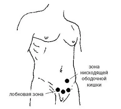 Рис 10 д Быстрый метод простукивания надавливания при запоре Правильный - фото 35