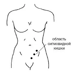 Рис 11 2После дефекации выпейте стакан теплой воды Застойные явления в - фото 36