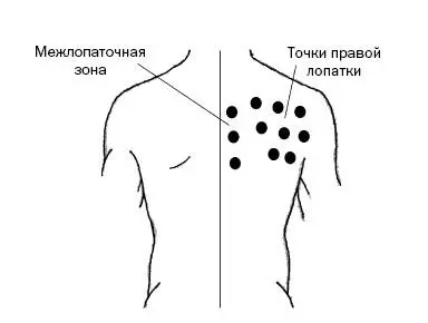 Рис 35 При печеночной колике Если нет возможности обратиться к врачу то - фото 100