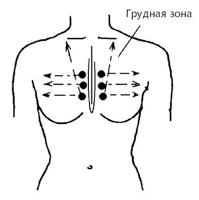 Рис 13 б Грудная зона Статичная установка стеклянных банок 1 способ - фото 45