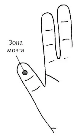Рис 58 аЗона мозга Рис 58 бЗоны при вегетососудистой дистонии Зона - фото 154