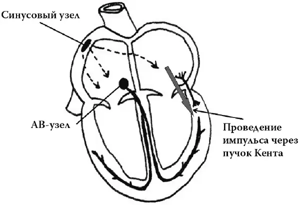 Неприятность возникает тогда когда электрический импульс в прямом направлении - фото 27