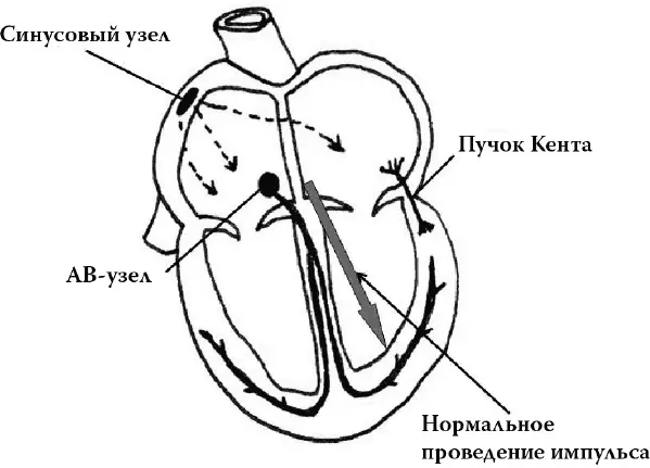 Нередко бывает так что возбуждение проводится на желудочки только через - фото 26