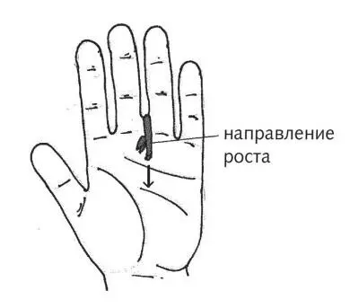 Рис 31 г Биотерапия при простатите Чем больше зон на ладонях и стопах мы - фото 75