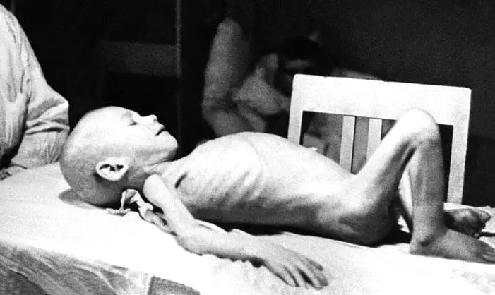 Блокада Ленинграда Ребенокдистрофик 1942 г Автор ТАСС Местные жители - фото 166