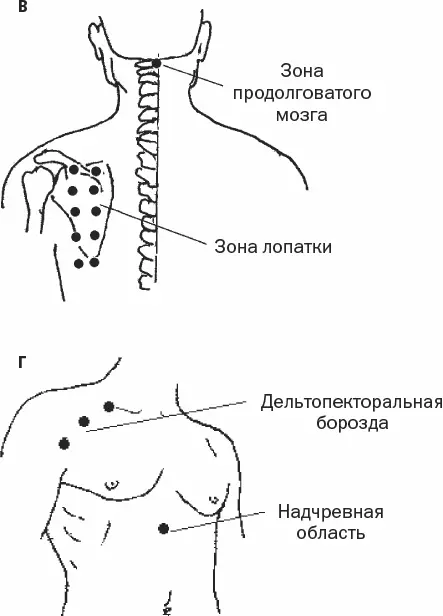 Рис 48Укрепление миокарда окончание 4 Область прикрепления большой - фото 119