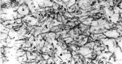 Рис 2 Микроскопия вытяжки из легочной ткани больного аспиргиллезом - фото 4