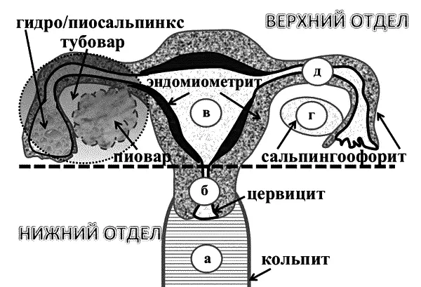 Рисунок 9 Воспалительные процессы половых органов а влагалища б шейки - фото 15