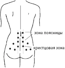 Рис 10 При зажиме поясницы Смещение межпозвоночных дисков Если в результате - фото 16