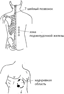 Рис 14 а б Вакуумбанки для эндокринной системы Действуем следующим - фото 22