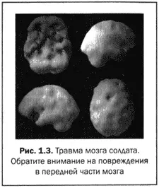 Но что будет если мы улучшим деятельность мозга Повлияет ли это на разум Вот - фото 4