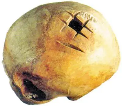 Inka cranium лат В центре вид картофеля в форме черной пятипалой кисти - фото 3