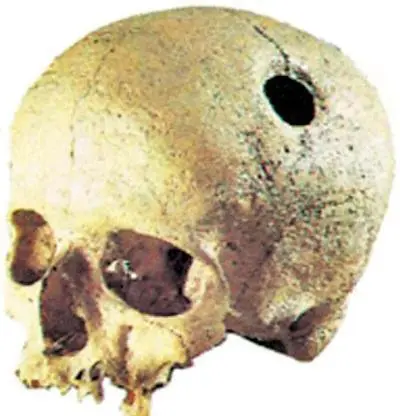 Inka cranium лат В центре вид картофеля в форме черной пятипалой кисти - фото 4