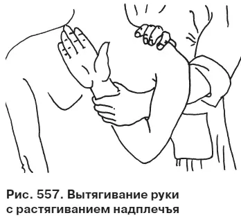 Нарушение менструального цикла У женщин эти расстройства составляют самые - фото 558