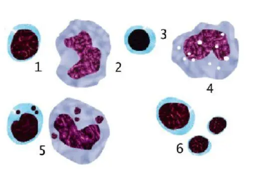 Рис 149 Патологические формы гранулоцитов 1 микроформы гранулоцитов 2 - фото 119
