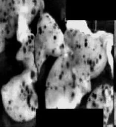 Рис 52Уменьшение очагов метастазирования в легких после питья католита Самое - фото 64