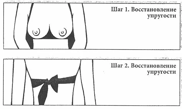 Подтяжка верхней части груди Тренировка мышцы находящейся за жировой тканью - фото 4