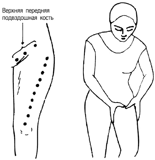 Рис 73 Точки в паховой области и на передней стороне бедра Затем четырьмя - фото 73