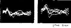 Рис V3 Запись электрических ответов на звуковой щелчок с помощью биполярных - фото 58