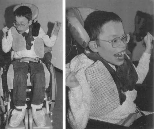 Рис 672 и 673 Изменения появившиеся уже через несколько месяцев 1 Мальчик - фото 146