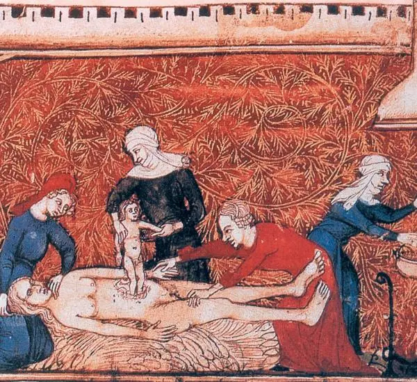 Рис 119 Старинное изображение кесарева сечения Франция якобы XV век - фото 22
