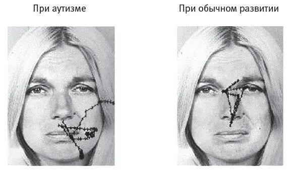 Рис 23Схемы движения глаз аутичного и нейротипичного человека Рис - фото 10