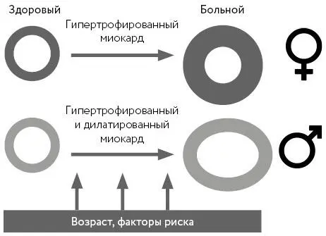 СН обусловленная жесткостью миокарда Изменения в сердце у мужчин и женщин - фото 15