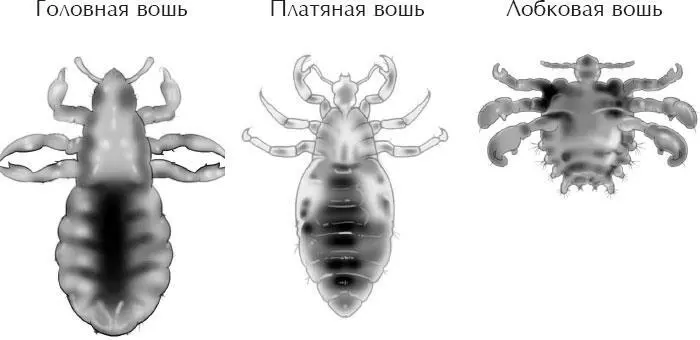 ВШИ Самый известный симптом чесотки запечатлен в ее латинском названии Scabere - фото 10