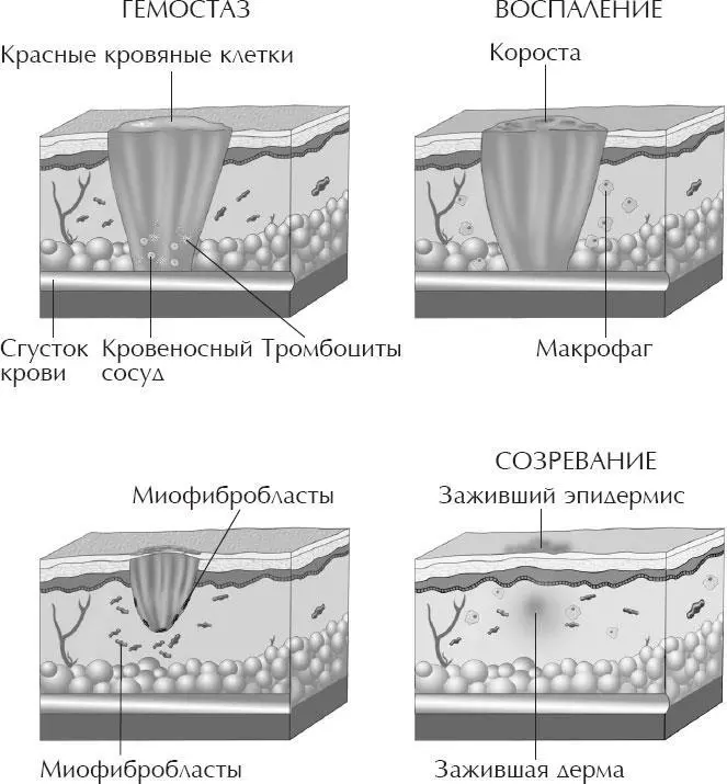 СИМФОНИЯ В ЧЕТЫРЕХ ЧАСТЯХ Заживление ран часто оставляет на коже постоянные - фото 23