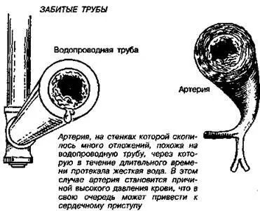 Конечно отрицательные последствия от закупорки артерий испытывают не только - фото 46